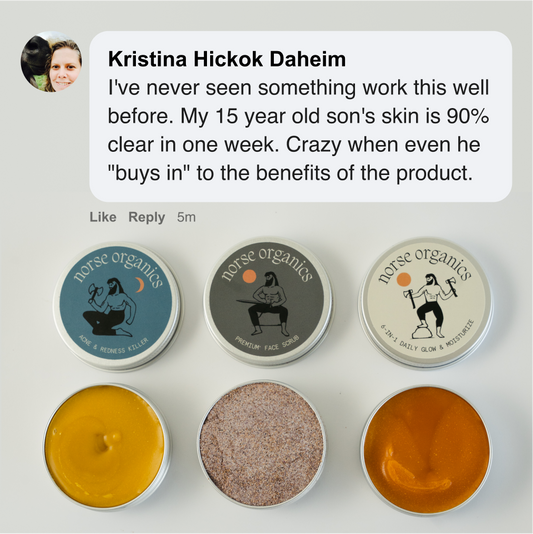 Ritual Membunuh Jerawat &amp; Kemerahan